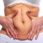 BodyTite for Targeted Fat Reduction: Areas That Can Be Treated 4 AdobeStock 93402921